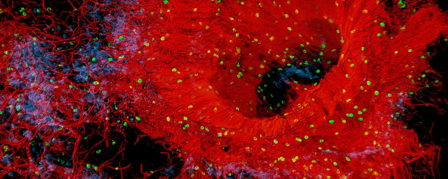 Human Lung Vasculature