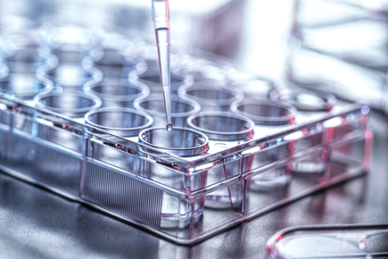 Testing tubes on lab tray